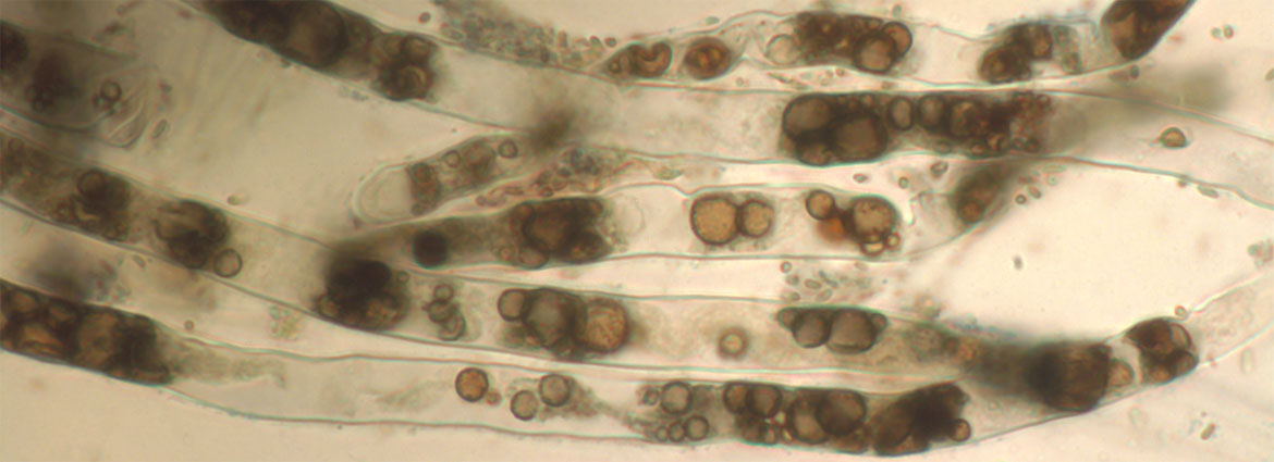 Cytoplasmic streaming in normal root hair - Image courtesy of Jim White