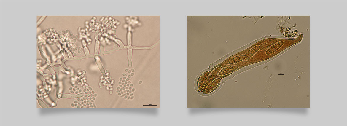 Fungal endophytes of switchgrass, fungal pathogens and their structures - Image courtesy of Ning Zhang